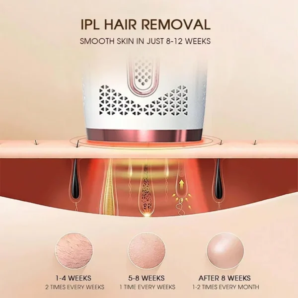 ⁦جهاز إزالة الشعر بالليزر Ipl المنزلي⁩ - الصورة ⁦4⁩