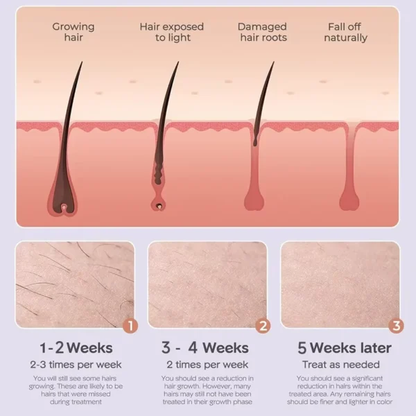 ⁦جهاز إزالة الشعر بالليزر Ipl المنزلي⁩ - الصورة ⁦6⁩
